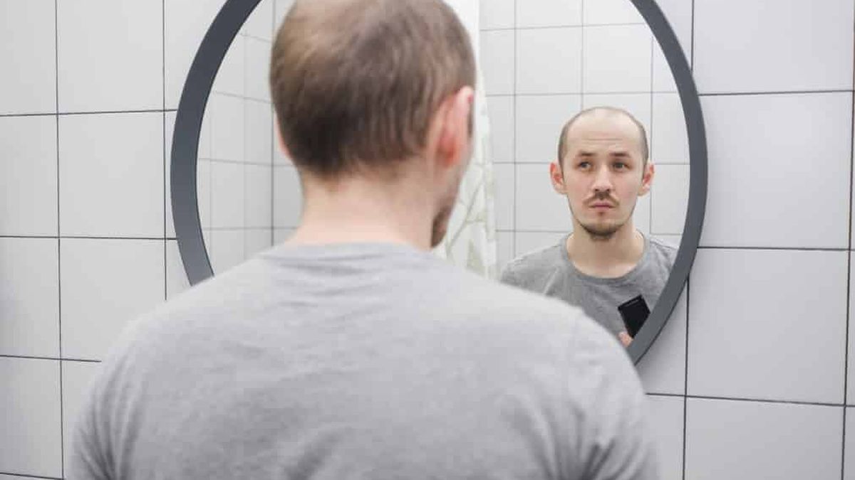 Comment se débarrasser définitivement de la calvitie