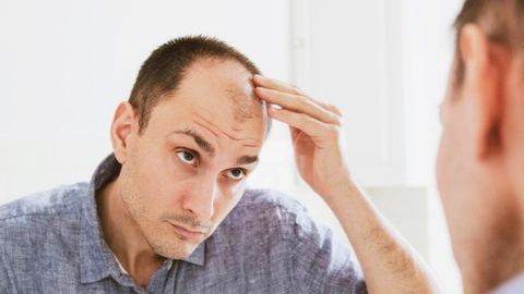 Preventing baldness: what solutions work?