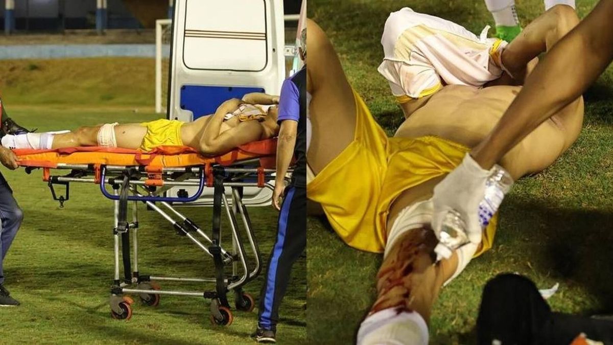 Un policía brasileño usa una bola flash contra el portero inmediatamente después del pitido final